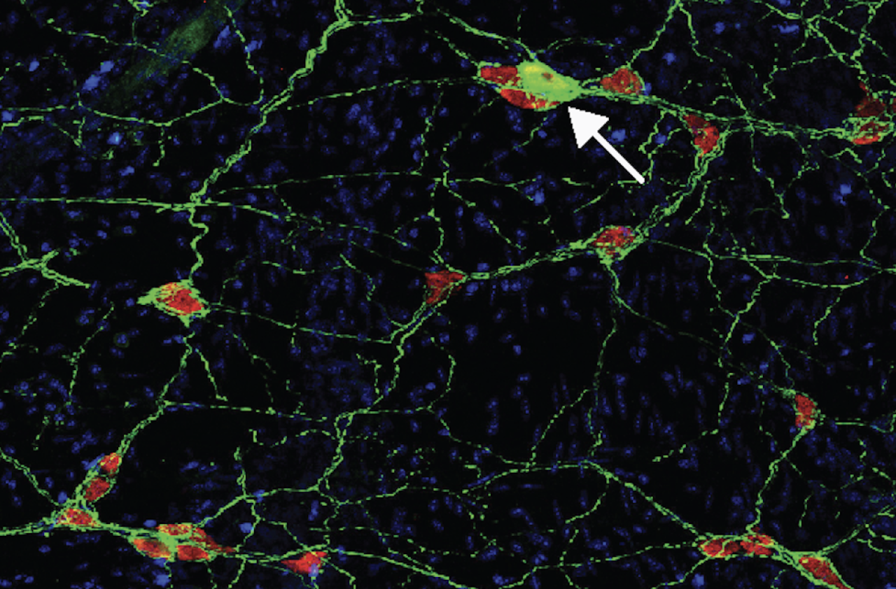 neurons in the gut of mice as seen under a microscope