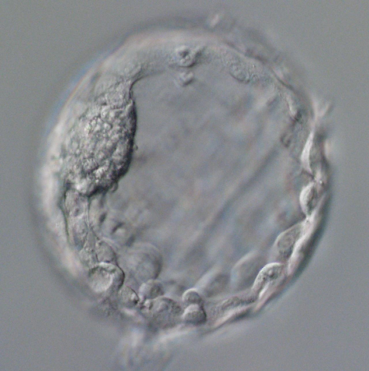 early human embryo under microscope