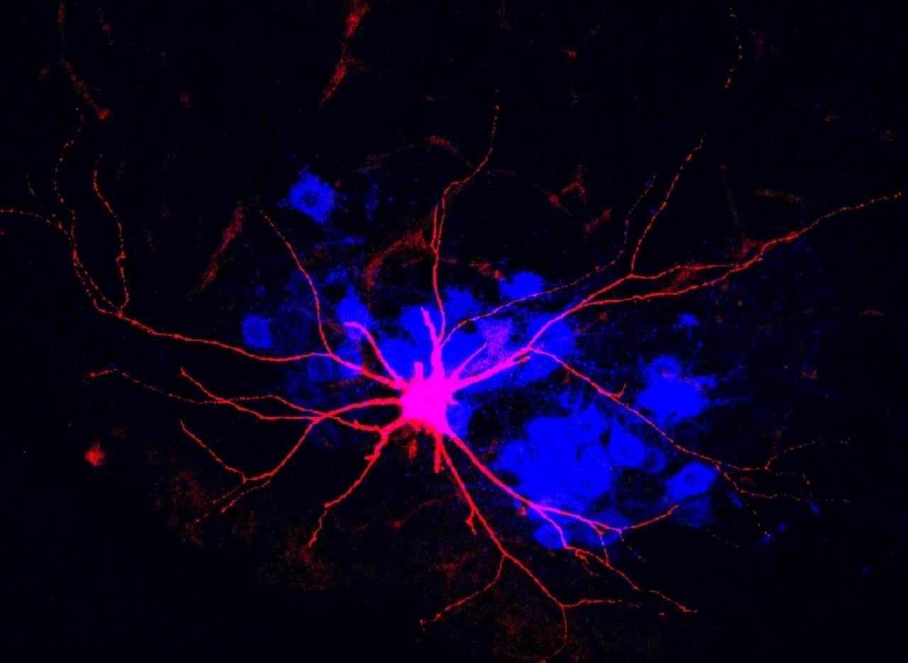 image of motor neuron under microscope