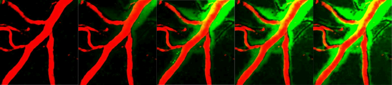 close up images of green tracer moving through the brain