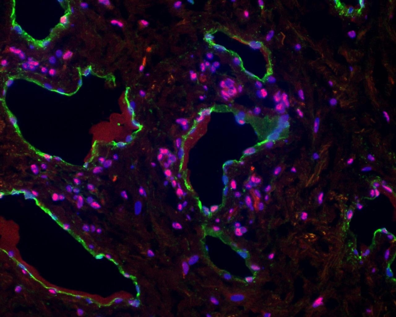 image of lymph vessels