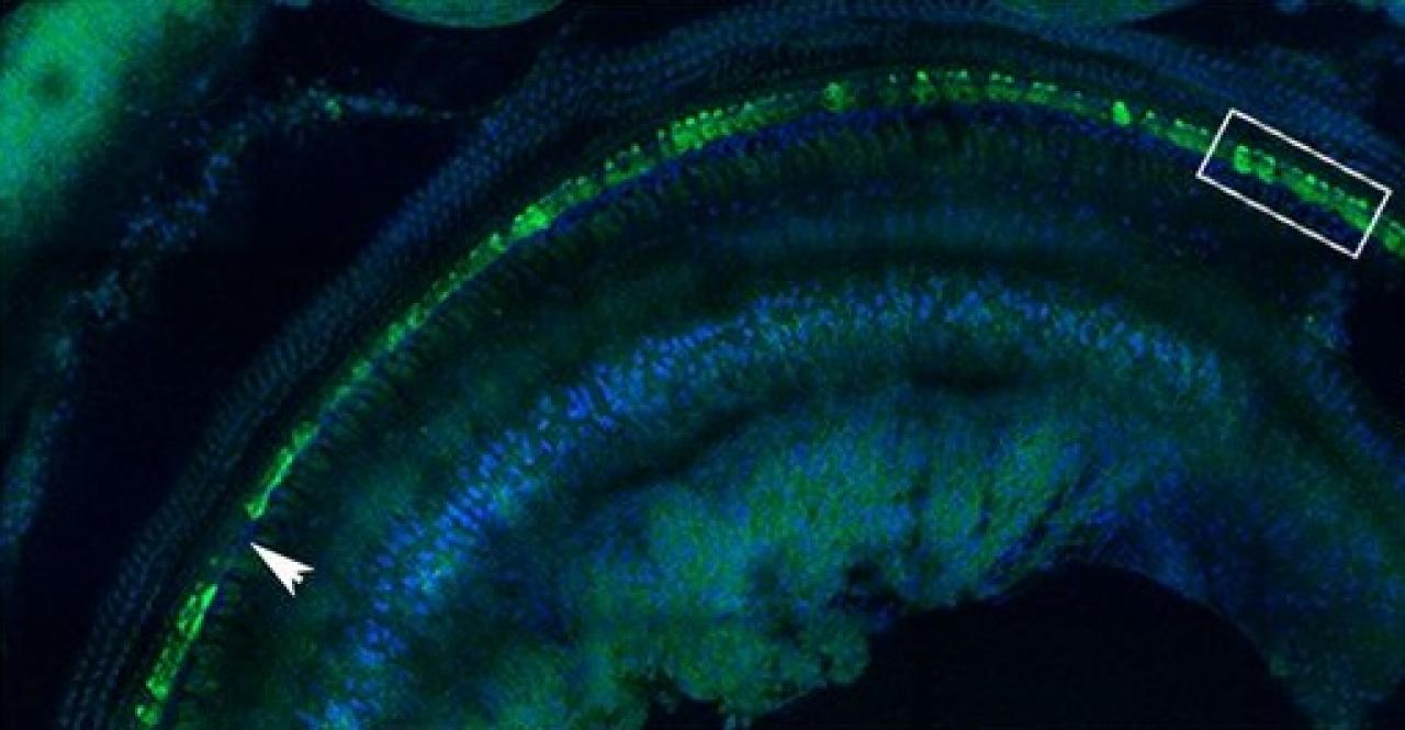 mouse cells in cochlea with corrected gene after therapy