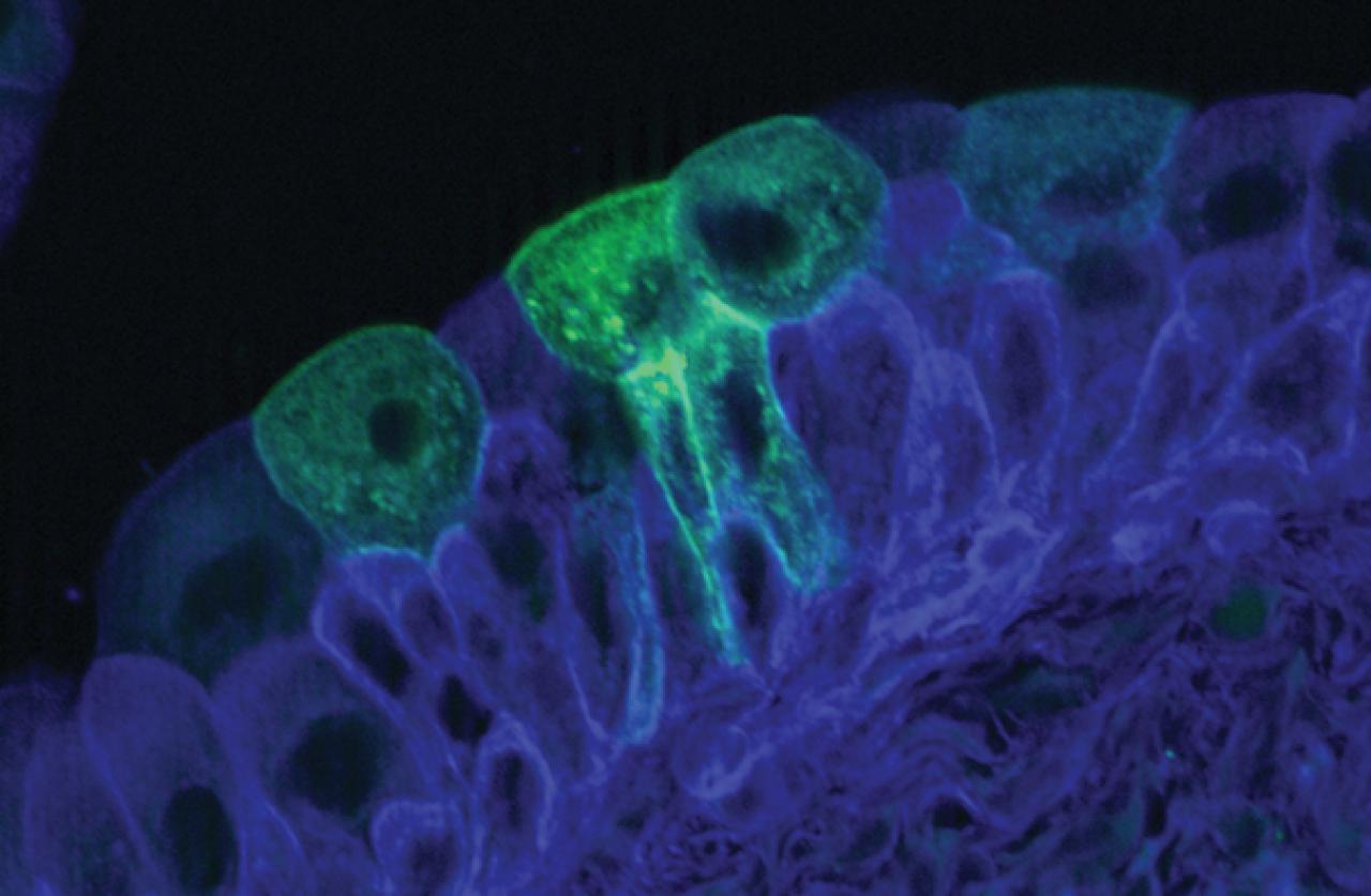 Researchers Discover Cells that Restore Bladder’s Unique Lining