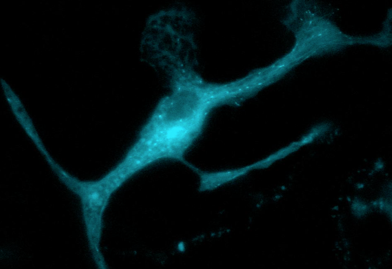 image of a microglial cell