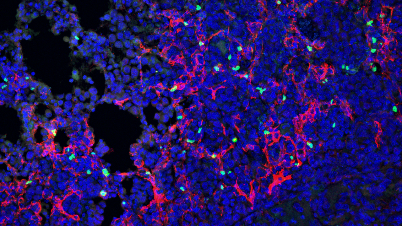 Scientists Uncover Hidden Cell Type That Shields Lung Cancer