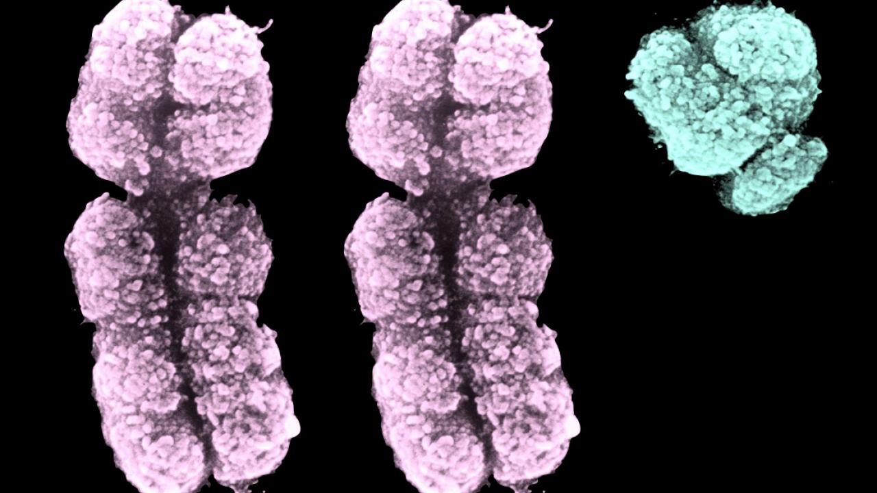 Developing A New Tool To Detect A Frequently Missed Sex Chromosome 