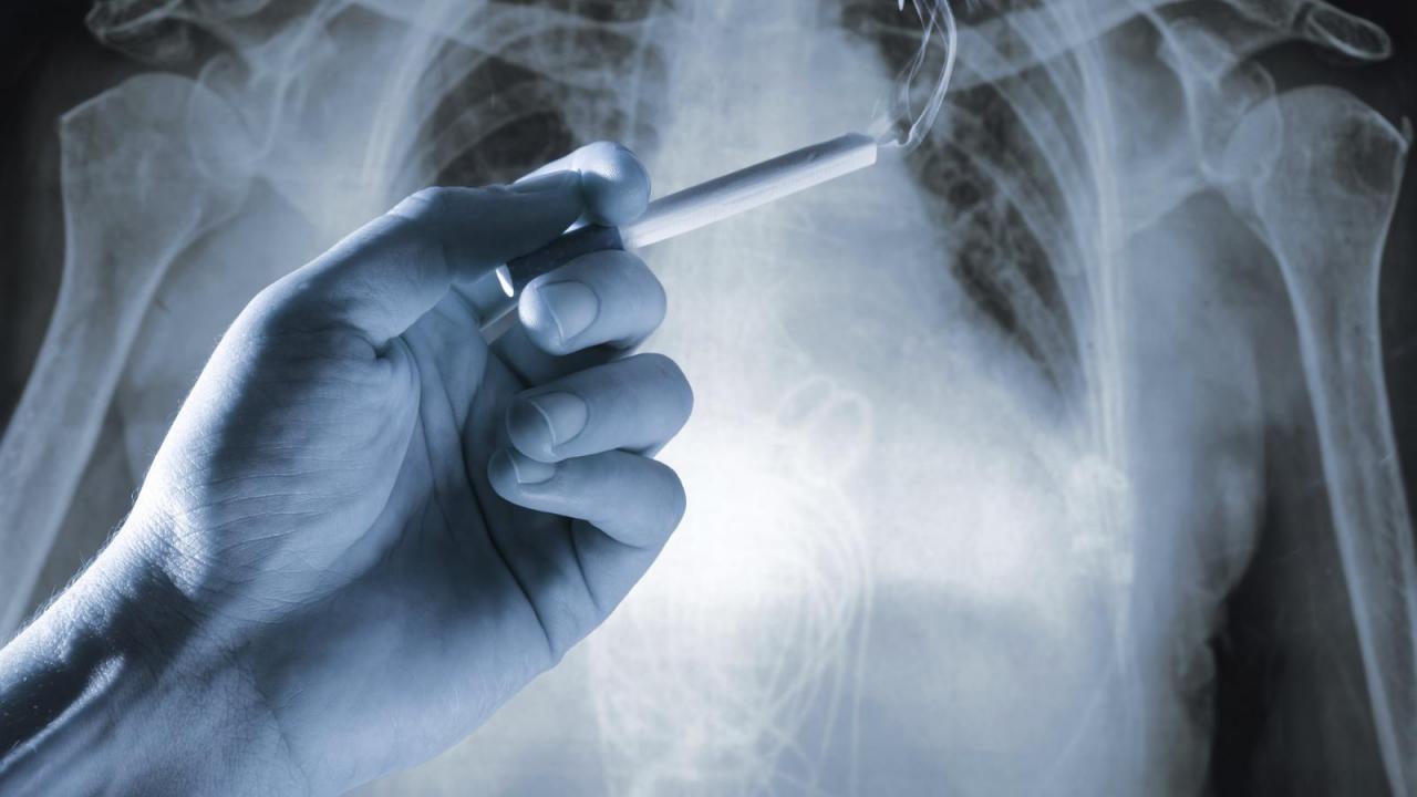 Half of Smokers with Normal Lung Function Have COPDLike Symptoms