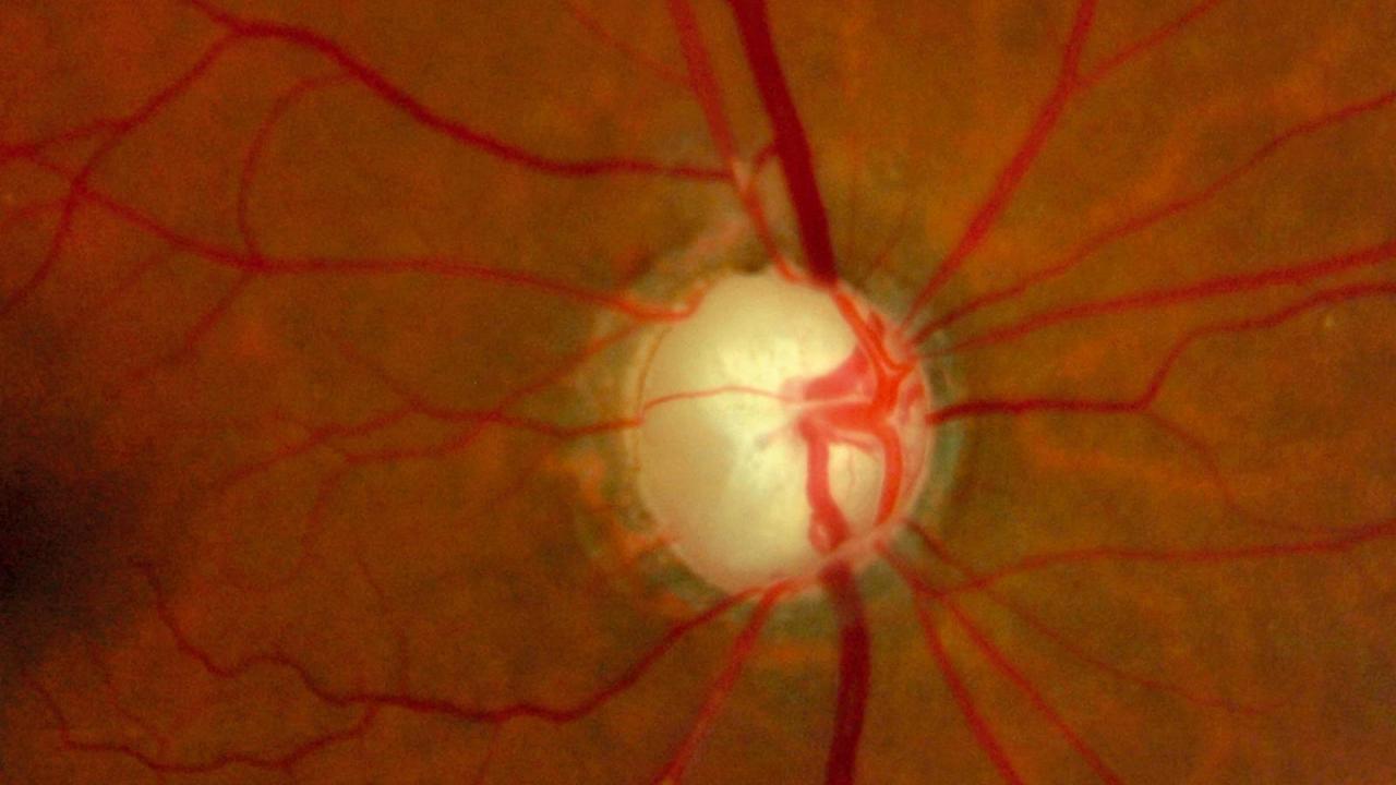 Vitamin B3 May Prevent Columbia University Irving Medical Center