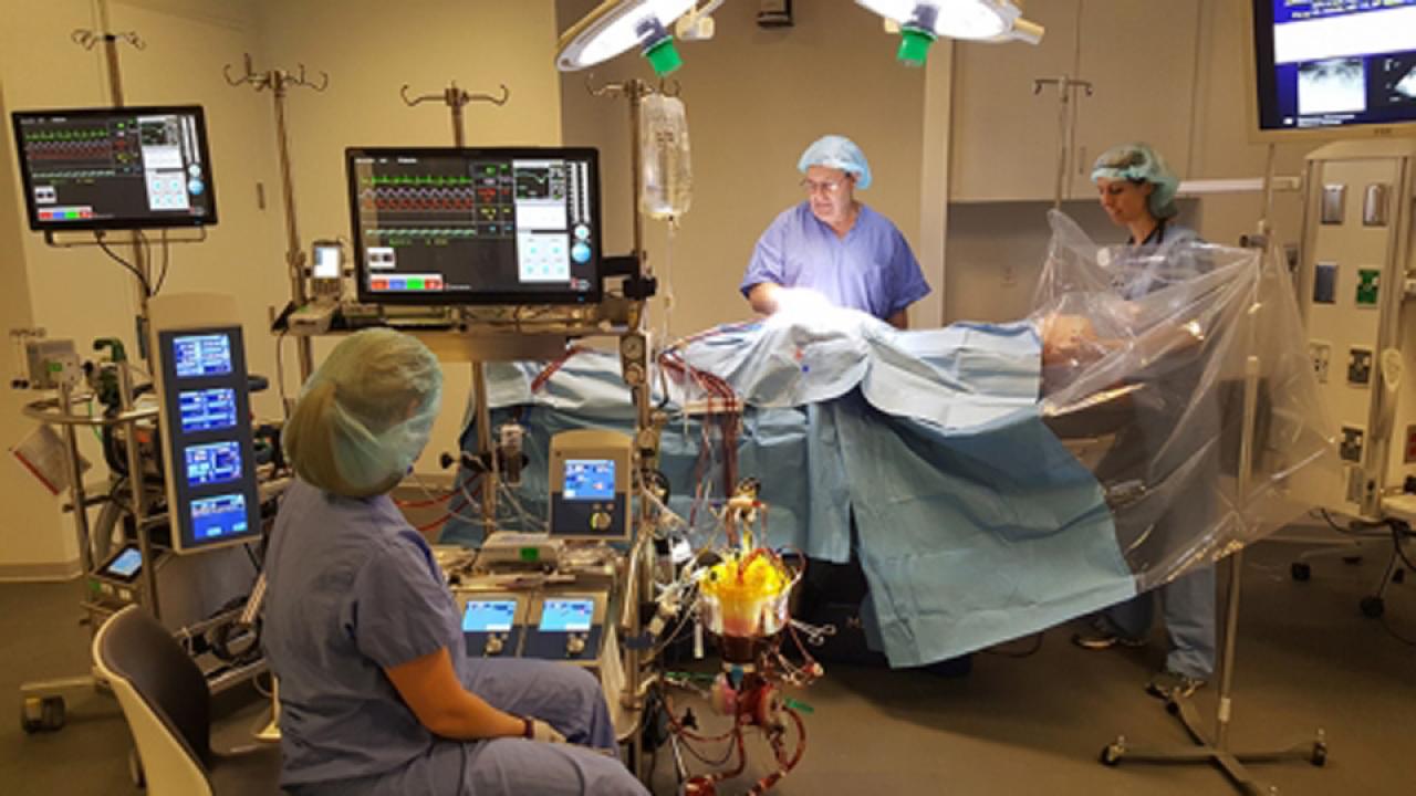ECMO Support May Save Lives in COVID19 Columbia