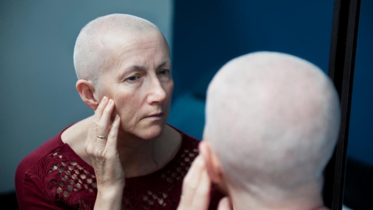 Is It Time to Offer Scalp Cooling to Prevent ChemoInduced Hair Loss