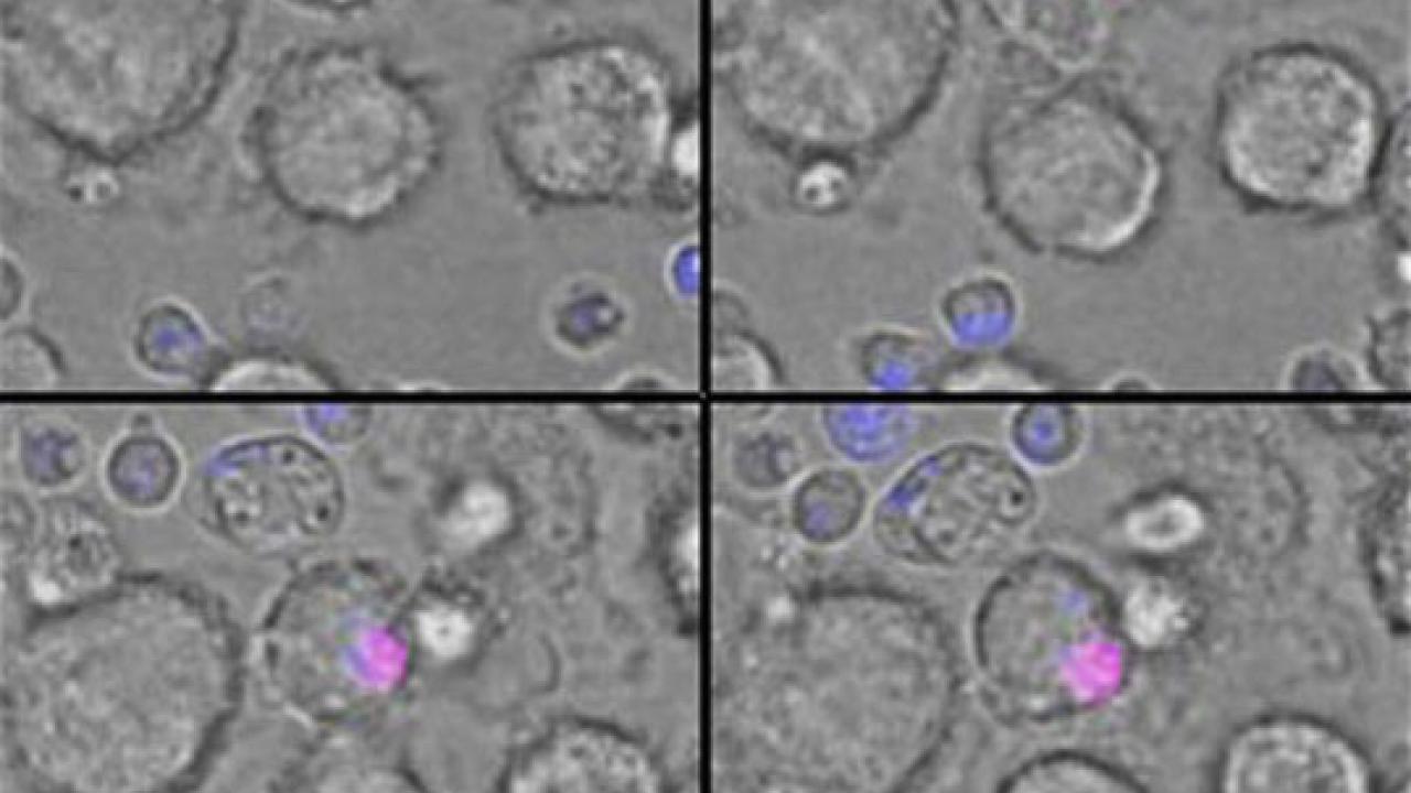 Change in Mitochondria is Critical for Clearing Dead Cells | Columbia  University Irving Medical Center