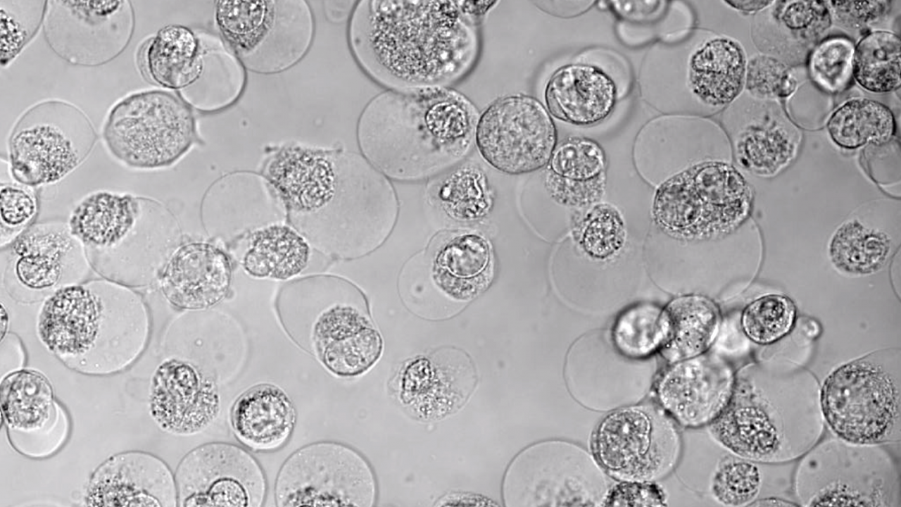 Starving Pancreatic Cancer of Cysteine May Kill Tumor Cells