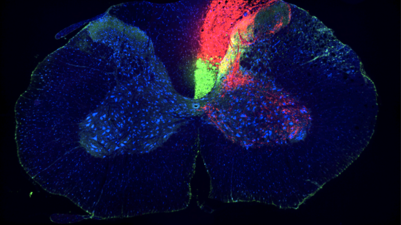 Spinal Cord Injury: Can Brain and Nerve Stimulation Restore