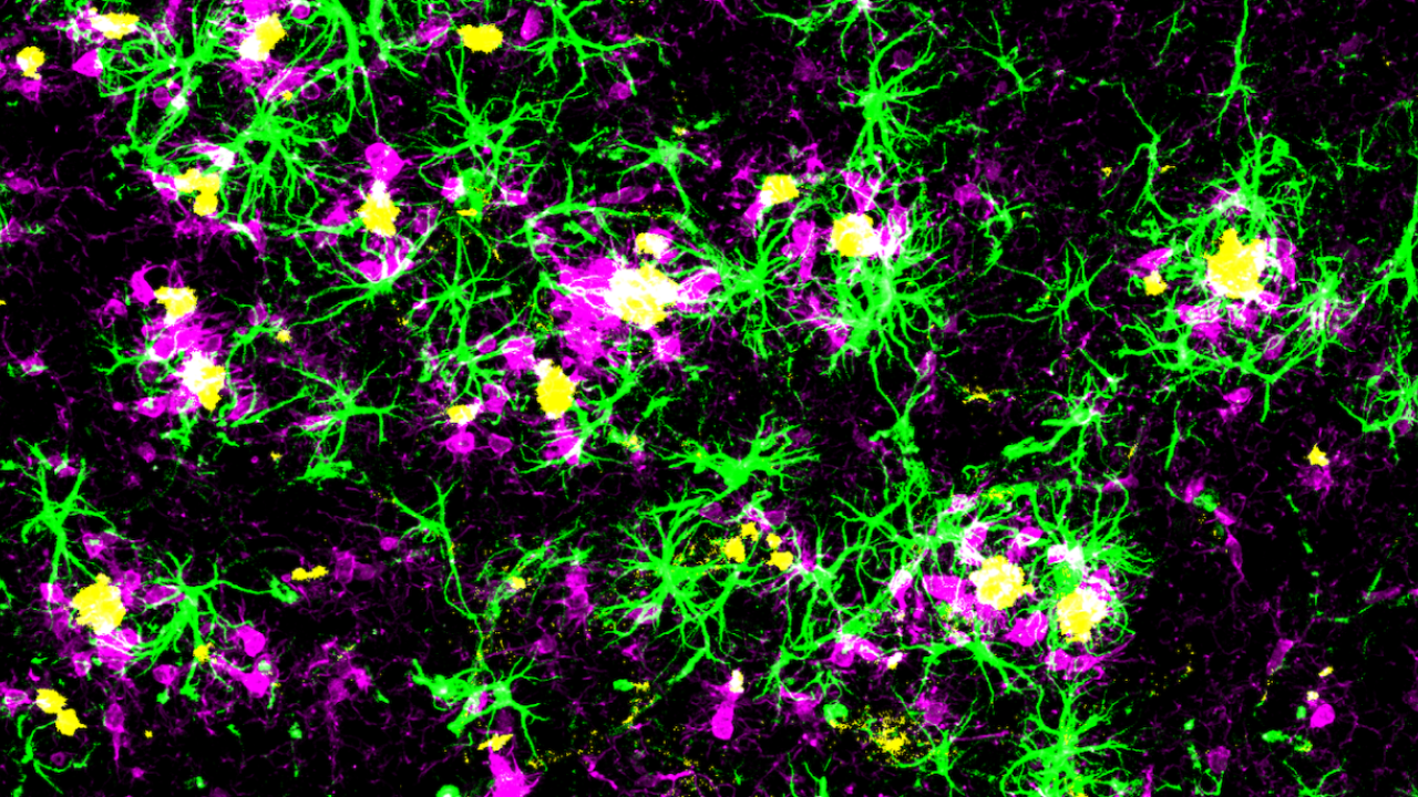 Upgrading Brain's “Dishwasher” May Help Clear Alzheimer's Toxins