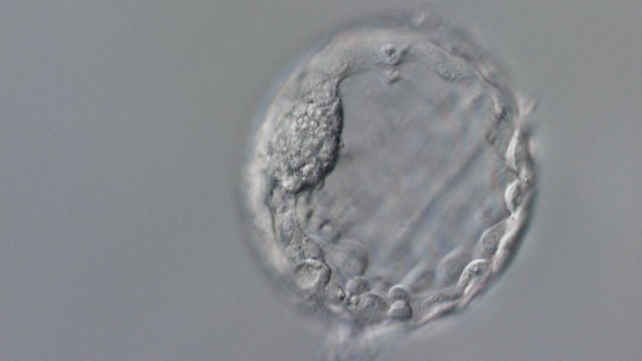 Photograph accompanying Base edits made before the first cell division persisted in every daughter cell of human embryos