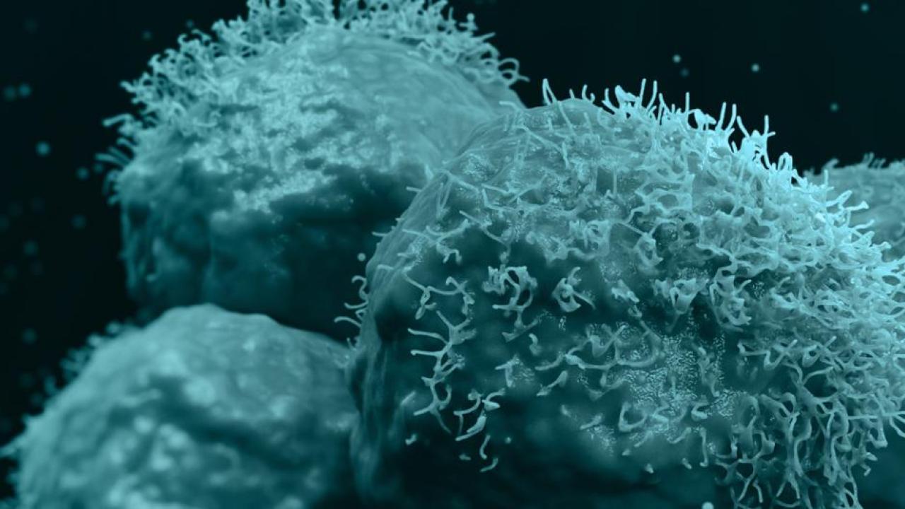 More Sensitive Cell Therapy May Be a HIT Against Solid Cancers ...
