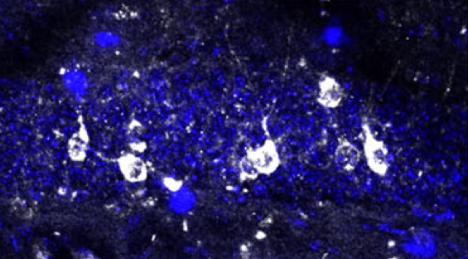 neurons as seen under a microscope