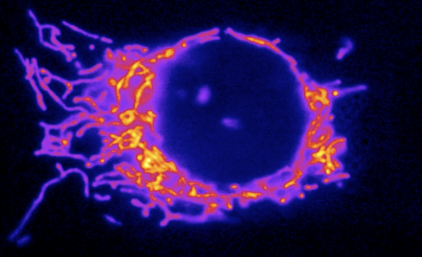 mitochondria surrounding a cell nucleus