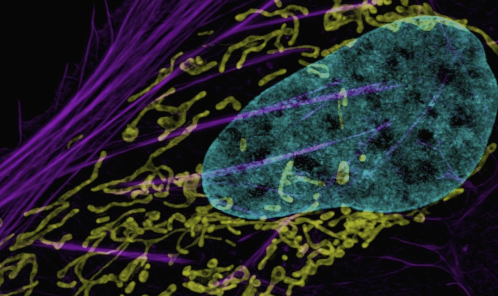 bacteria surrounding a cell