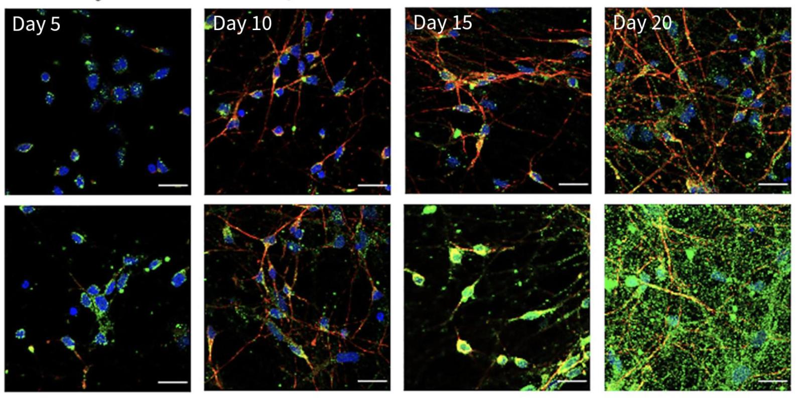 multiple images of neurons stained with different colored markers