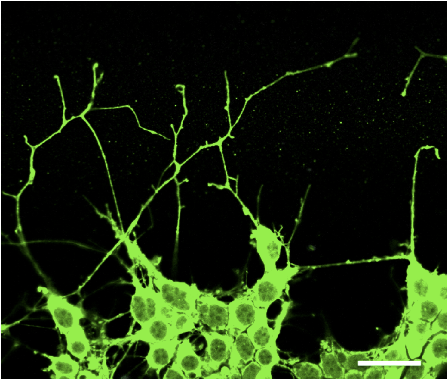 metastatic cancer cells sending out projections that look like axons
