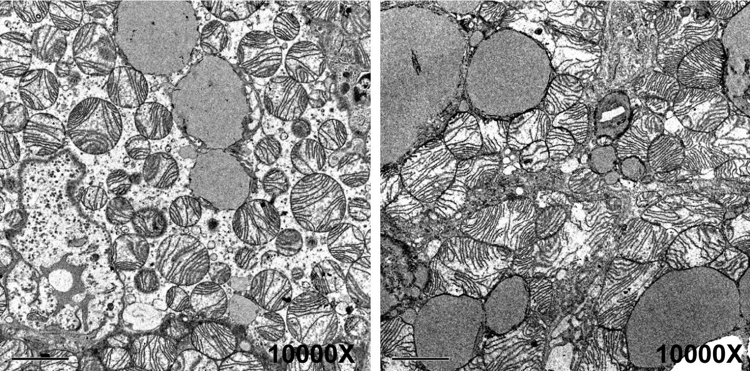 images of mitochondria in mouse cells