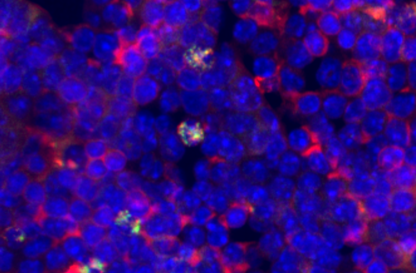 blood stem cells surrounded by other blood cells in bone marrow