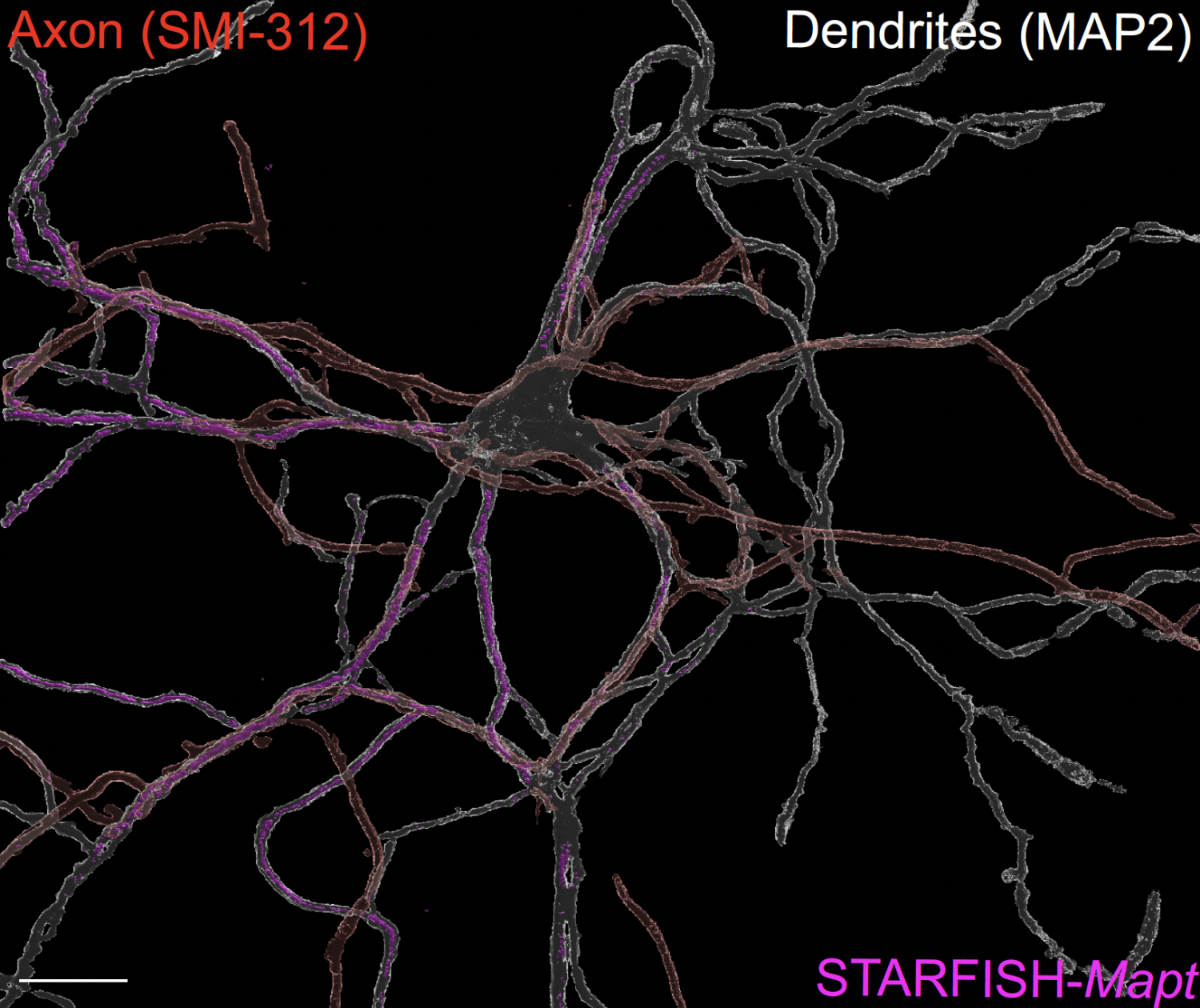image of neurons