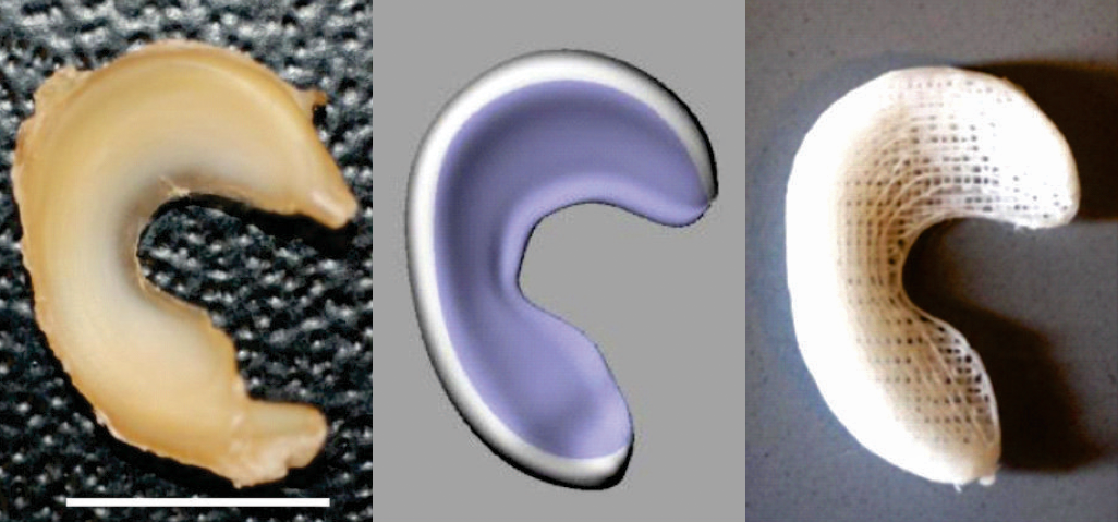 Meniscus Regenerated with 3-D Printed Implant - Meniscus3compare