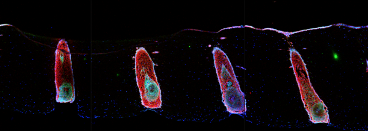 hair follicles grown in a dish