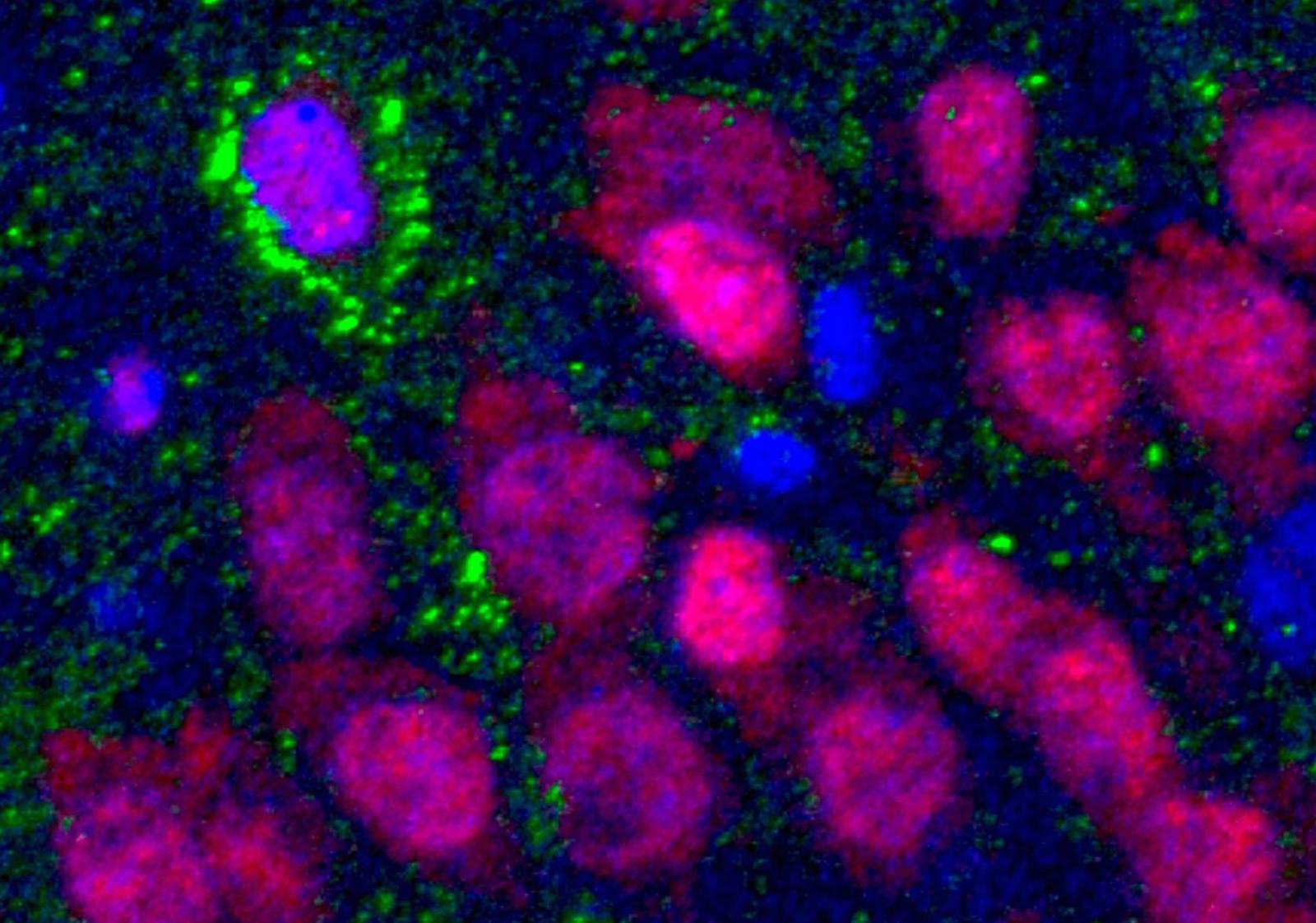 Even Old Brains Can Make New Neurons, Study Finds | Columbia University ...