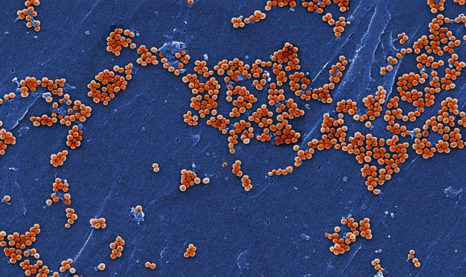 Superbug MRSA Bacteria Spread In Homes Columbia University Irving superbug-mrsa-bacteria-spread-in-homes-columbia-university-irving