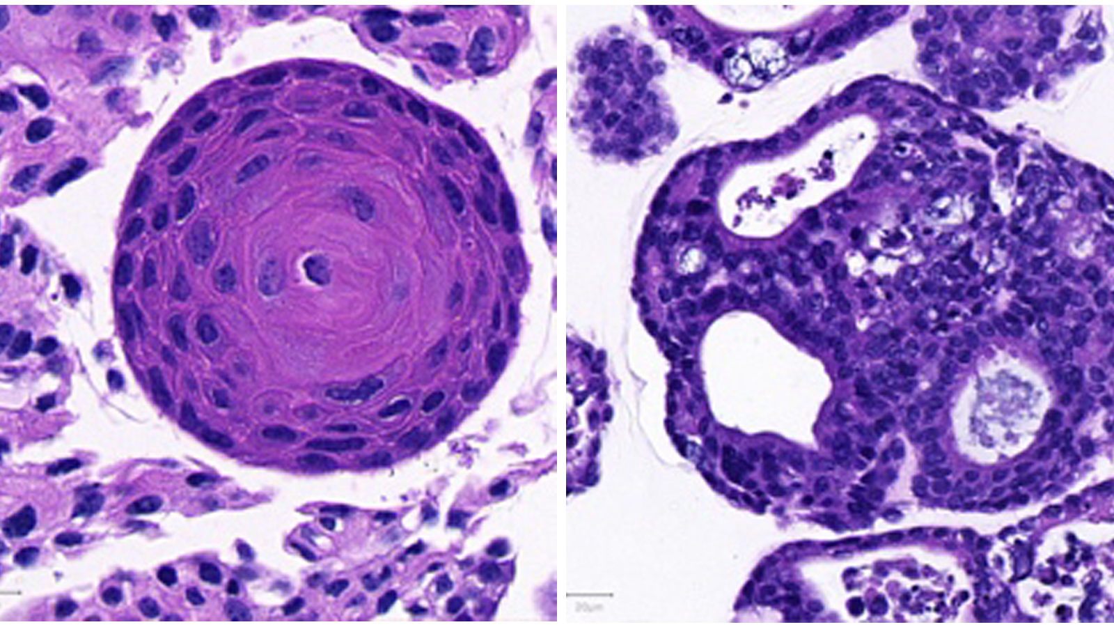 Normal and malignant esophageal Organoids