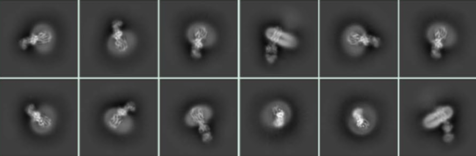 cryoEM images of the omega-3 transporter