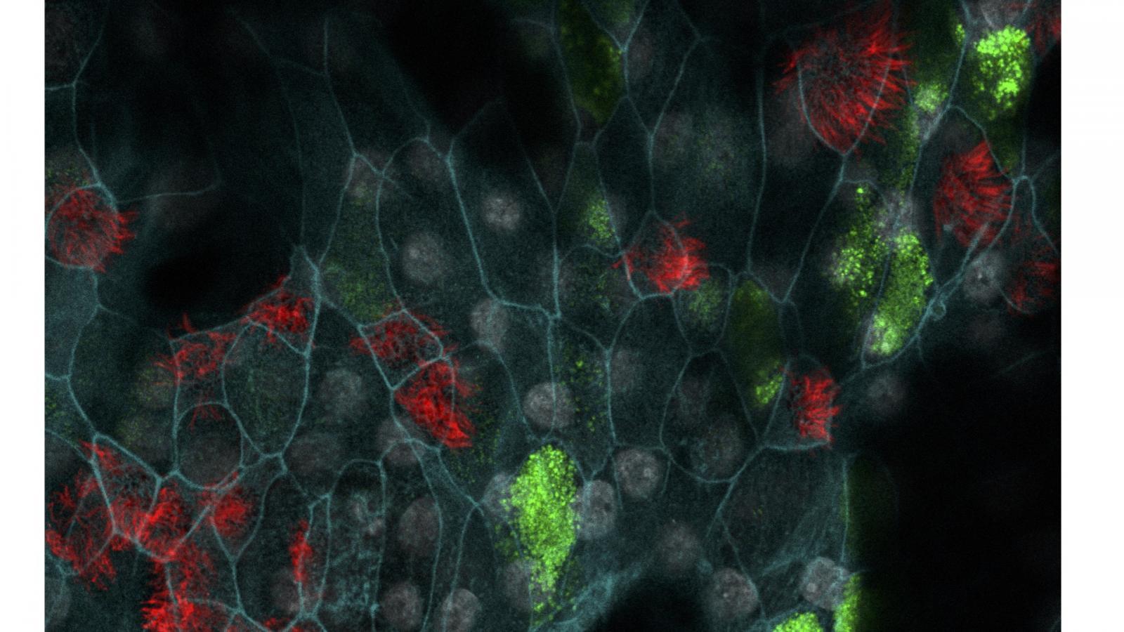 stem cells stem cells