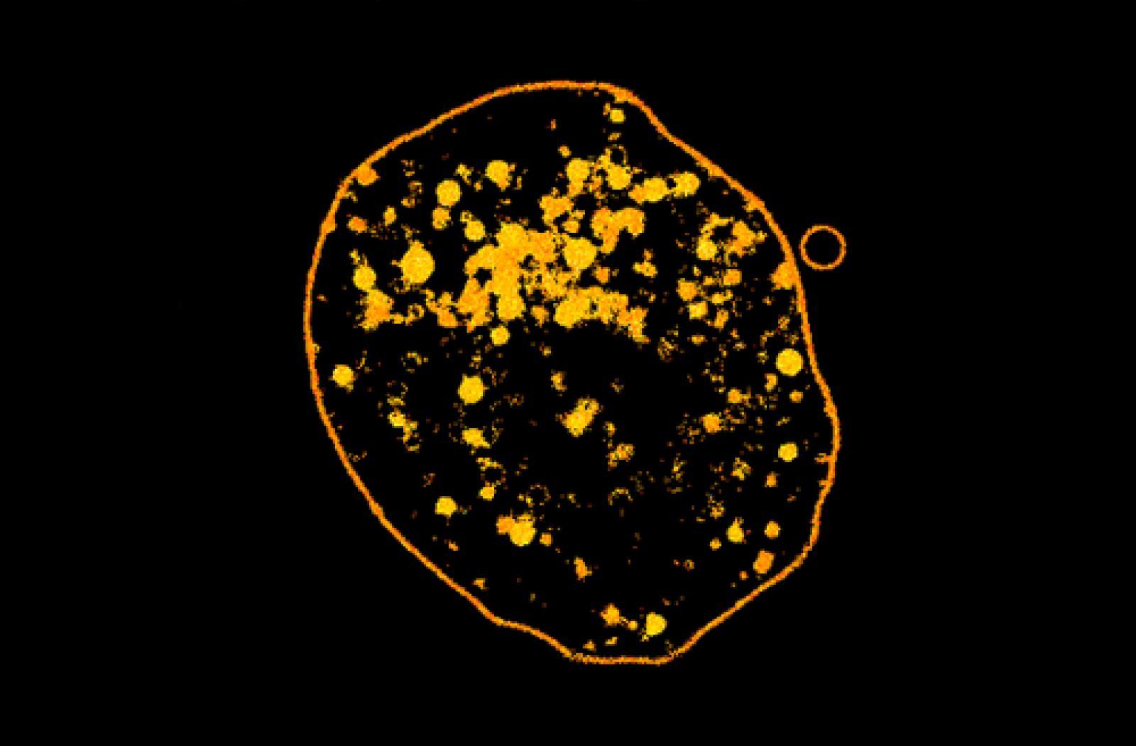 granules inside natural killer cells