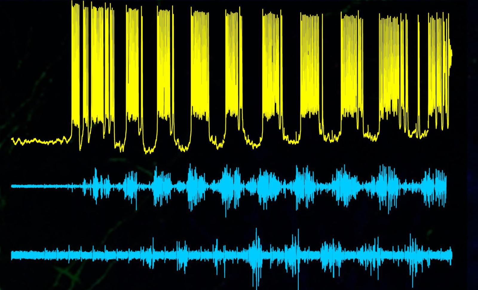 recordings of electrical impulses from spinal cord neurons