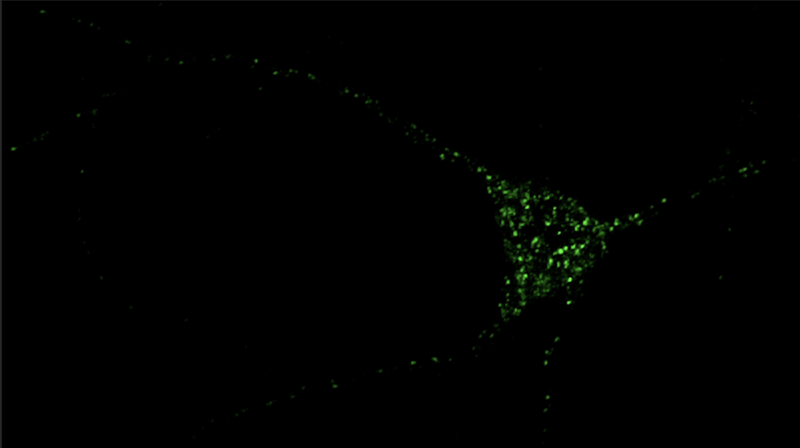 distribution inside a neuron of a potential new target for Alzheimers drugs