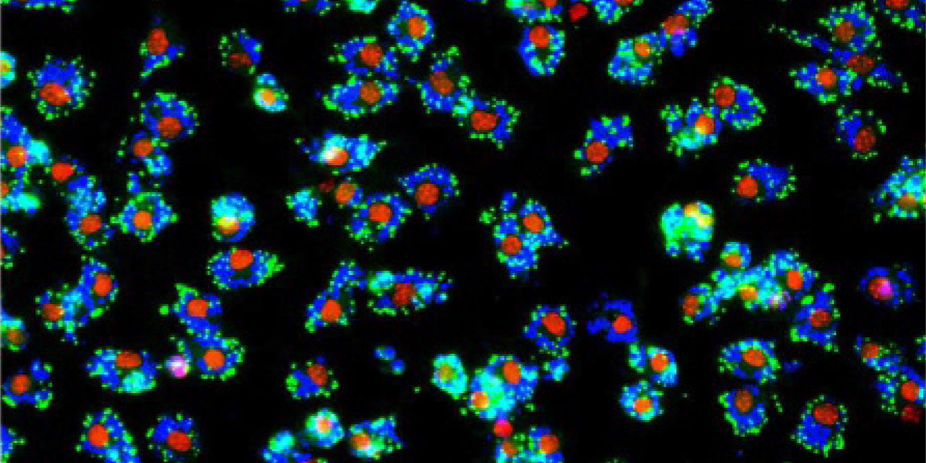 cells seen under a microscope