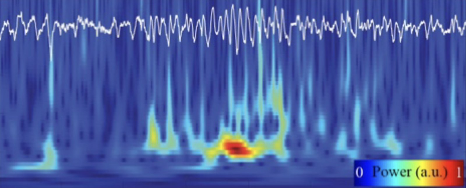 trace recordings of brain activity