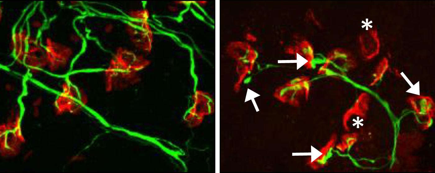 motor neurons as seen under microscope