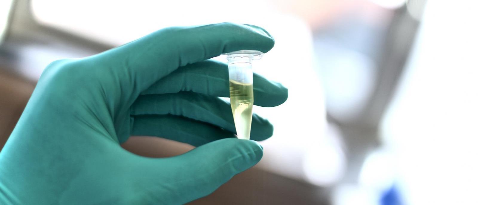 Spinal Fluid Test Offers Reliable Way to Diagnose Alzheimer’s