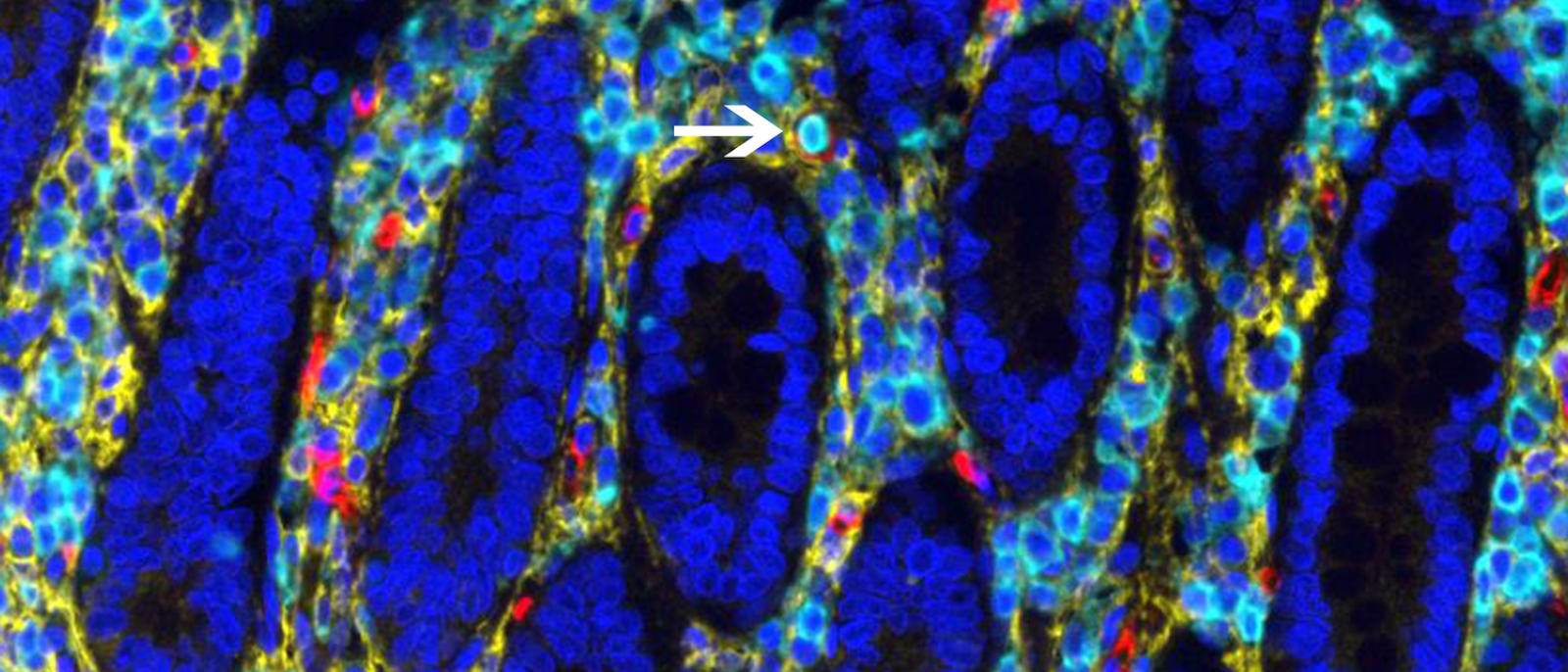 Human HSCs in intestine. Image: Megan Sykes / Columbia University