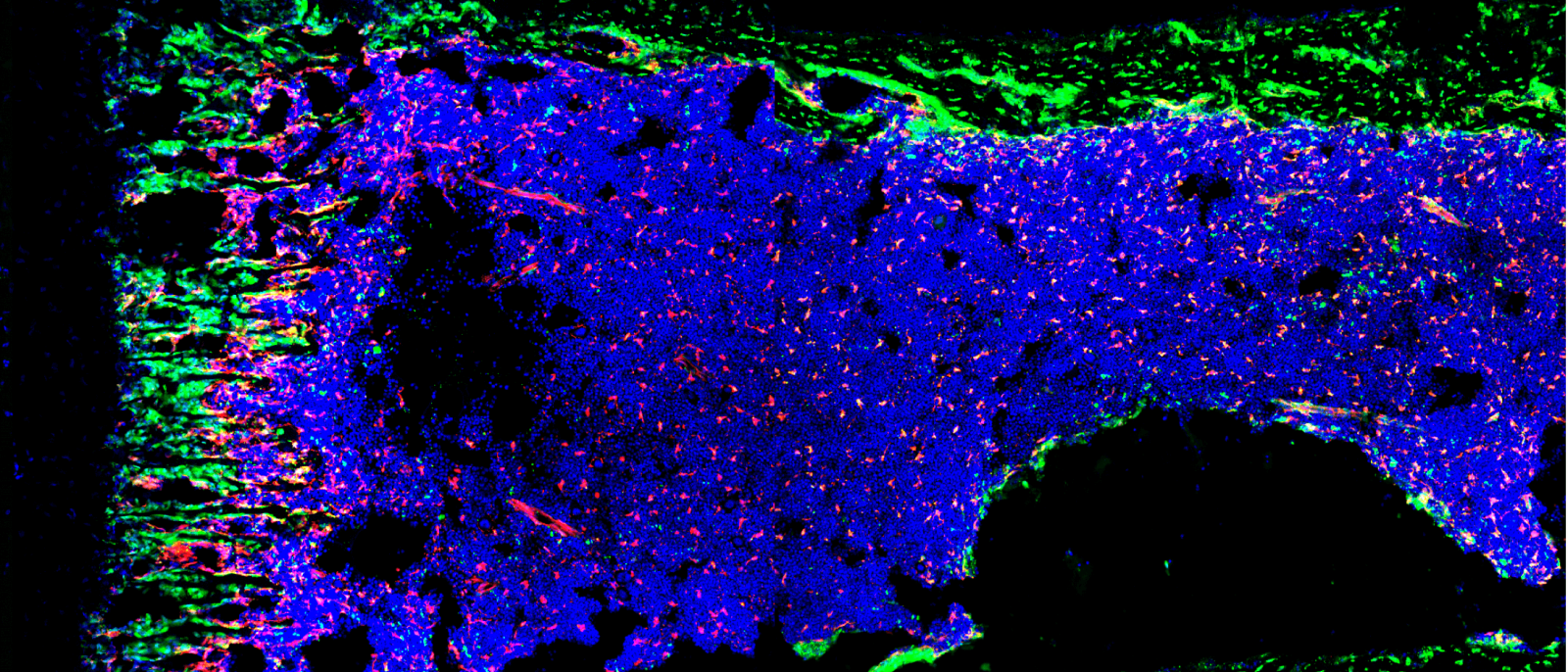 Building More Homes for Hematopoietic Stem Cells