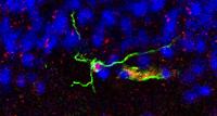 a-neural-stem-cell-in-the-brain