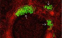 images ujawniają, jak bakterie MRSA agregują się w szczelinach płuc's crevices