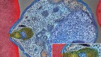 image of malaria parasite invading red blood cell