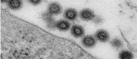 TEM of murine leukemia virus particles. Image: Stephen Goff / Columbia University