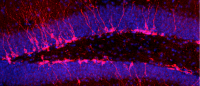 adult-born neurons (pink) in hippocampus of the brain | Image from René Hen