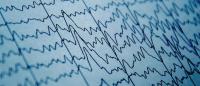Getty Images EEG graph